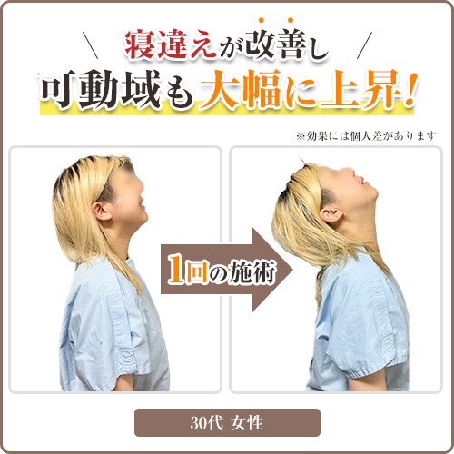 ビフォーアフター